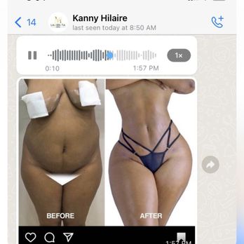 Achieving Your Dreams: Plastic Surgery in Atlanta Achieving Your Dreams: Plastic Surgery in Atlanta