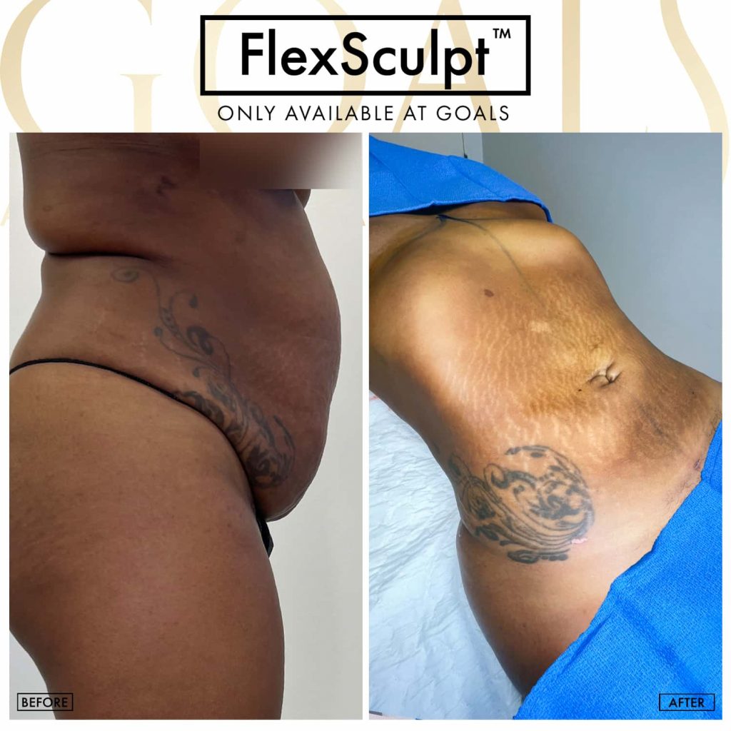 Achieving Your Goals with Plastic Surgery in Maryland Achieving Your Goals with Plastic Surgery in Maryland