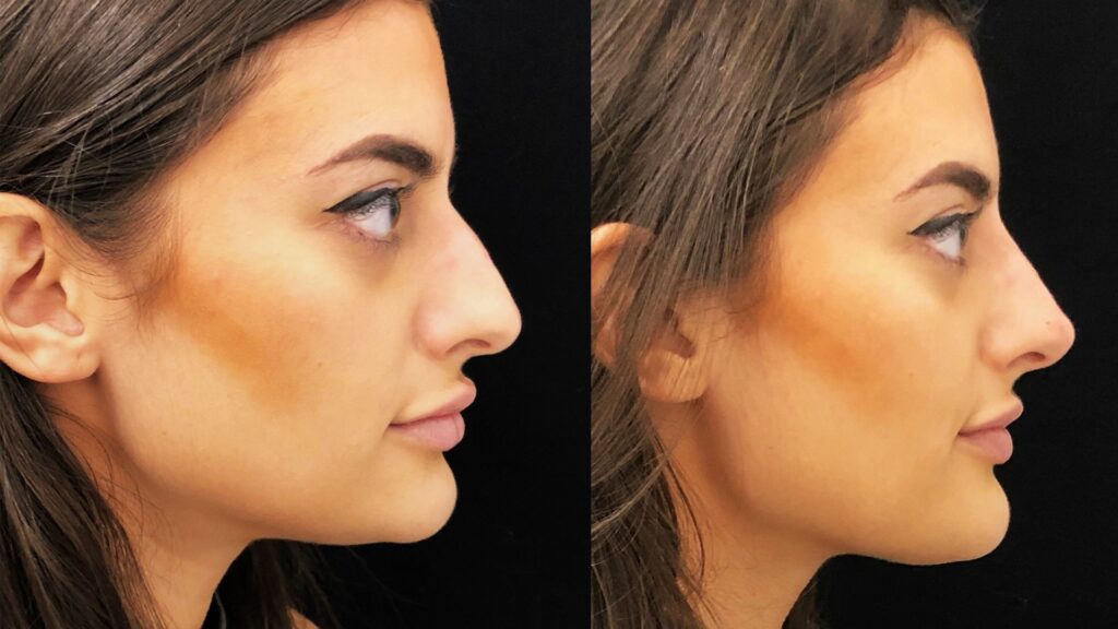 Attaining Your Dream Look with Plastic Surgery Attaining Your Dream Look with Plastic Surgery