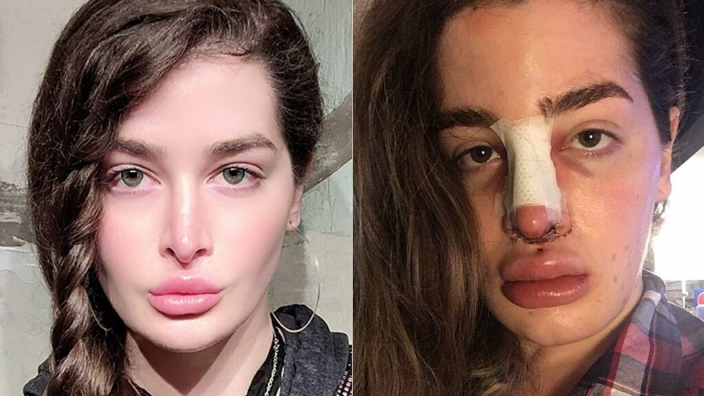 Attaining Your Dream Look with Plastic Surgery Attaining Your Dream Look with Plastic Surgery