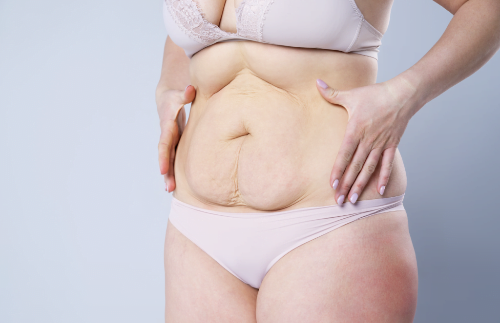 Bronx Plastic Surgery: Sculpting the Body Youve Always Wanted