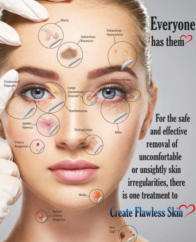 Common Skin Conditions Treated with Lamprobe