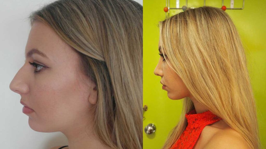 Considering Plastic Surgery? Read These Reviews First! Considering Plastic Surgery? Read These Reviews First!