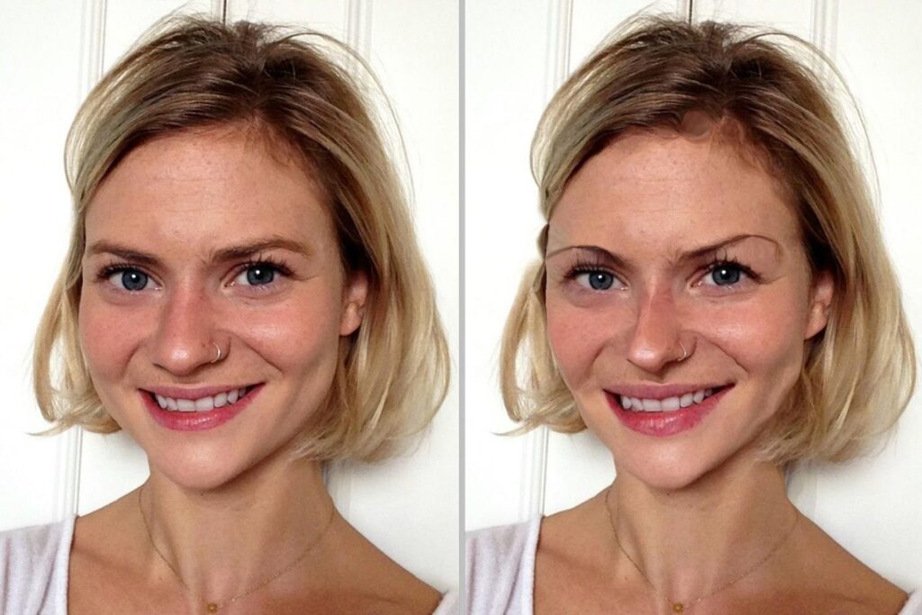 Designing Your Dream Look through Plastic Surgery