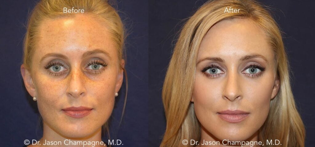 Enhancing Your Beauty with Plastic Surgery in Maryland