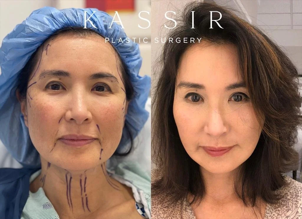 Experience the Magic of Plastic Surgery in NYC