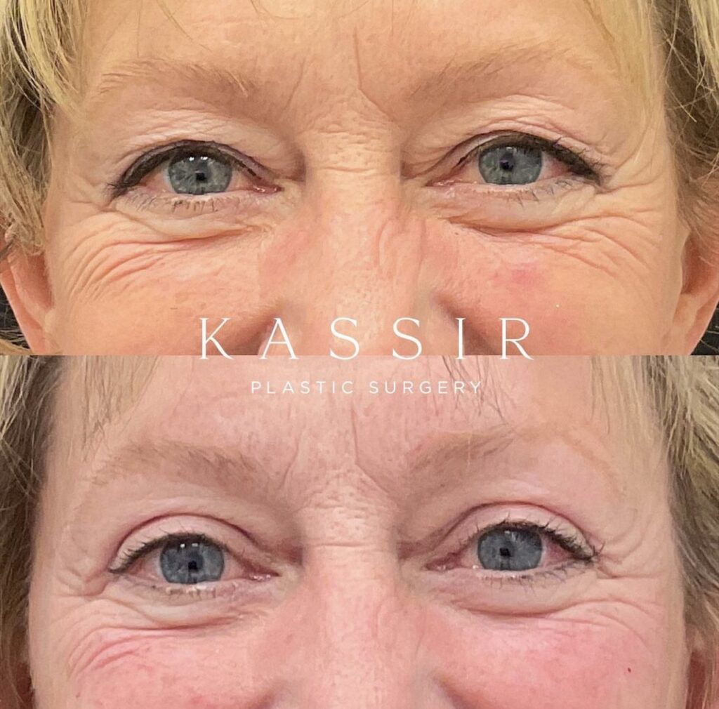 How Plastic Surgery Can Help You Reach Your Vision How Plastic Surgery Can Help You Reach Your Vision