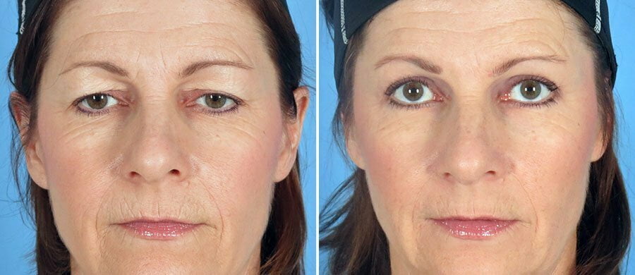 How Plastic Surgery Can Help You Reach Your Vision How Plastic Surgery Can Help You Reach Your Vision