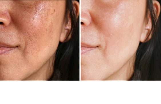 Lamprobe: A Non-Invasive Solution for Sunspots