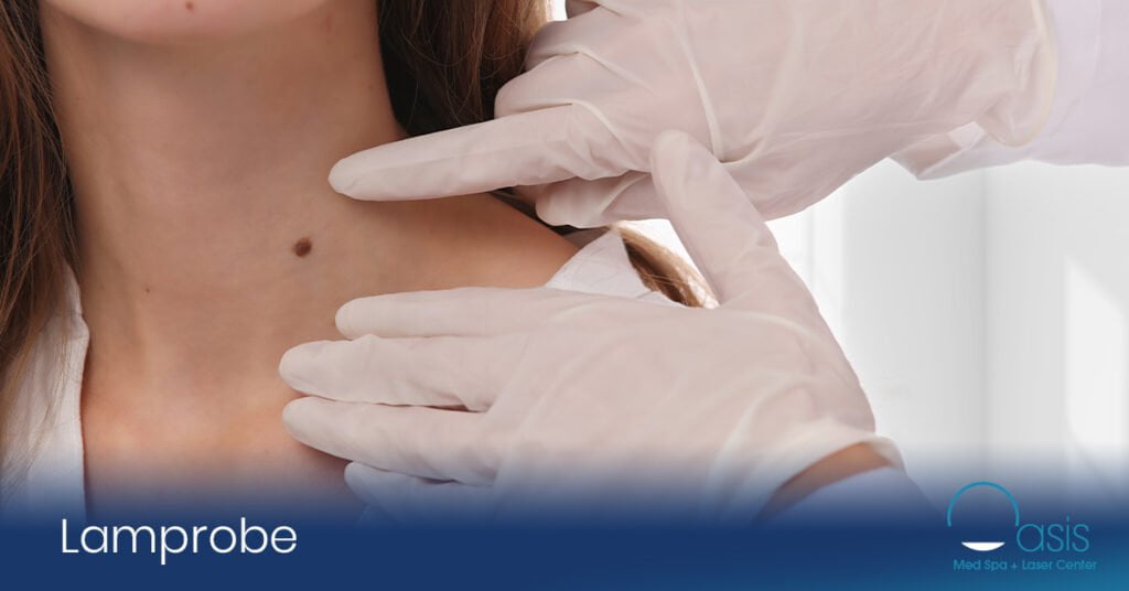 Lamprobe: A Non-Invasive Solution for Sunspots