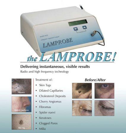 Lamprobe vs. Other Skin Resurfacing Techniques