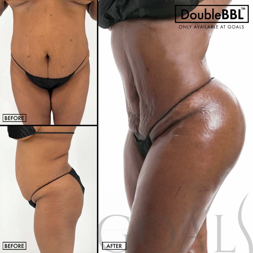 Meet Your Aesthetic Goals with Plastic Surgery Meet Your Aesthetic Goals with Plastic Surgery