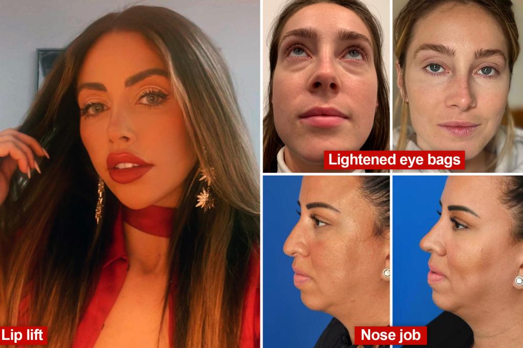 Plastic Surgery in NYC: A Path to Your Dream Look