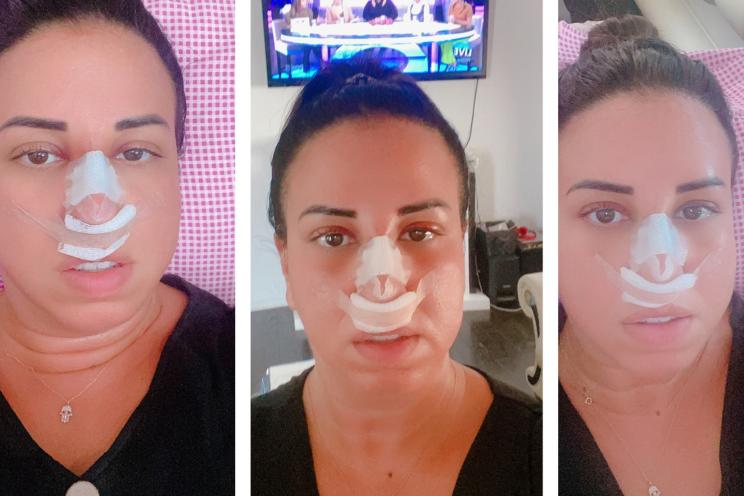 Plastic Surgery in NYC: A Path to Your Dream Look