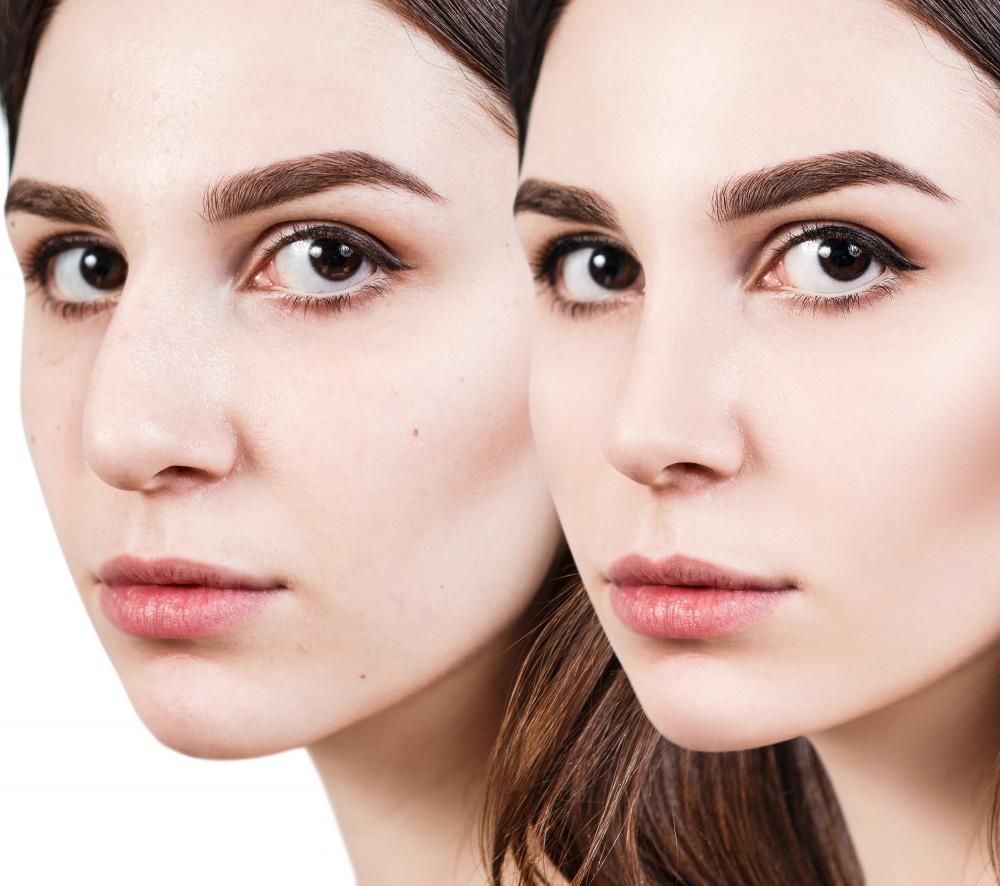 Reaching Your Desired Look through Plastic Surgery in Maryland