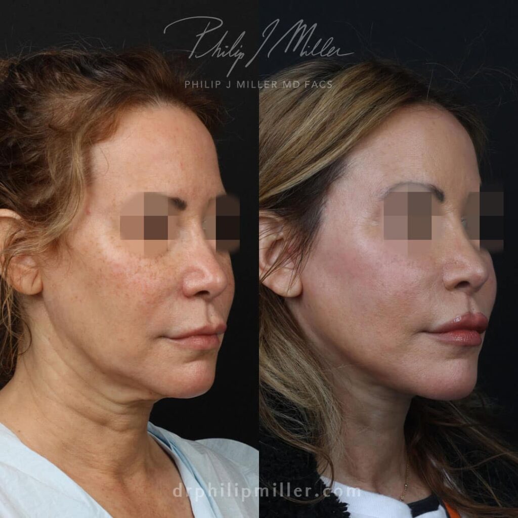 Rejuvenate Your Appearance with Plastic Surgery in NYC Rejuvenate Your Appearance with Plastic Surgery in NYC