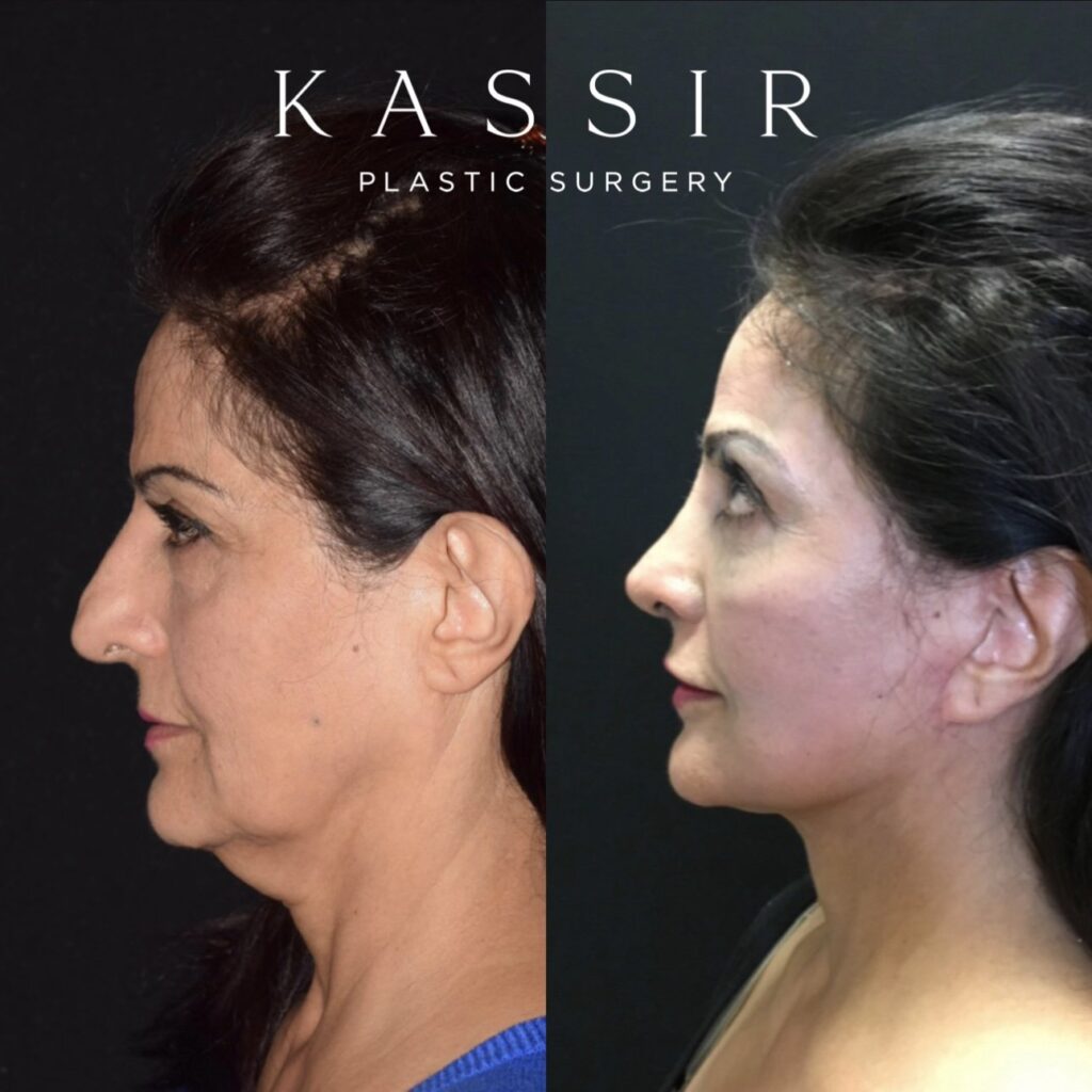 Rejuvenate Your Appearance with Plastic Surgery in NYC Rejuvenate Your Appearance with Plastic Surgery in NYC
