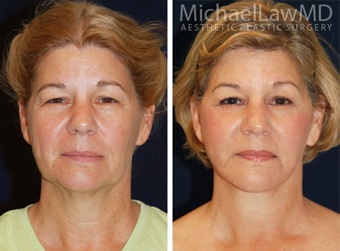 Revitalizing Your Appearance with Plastic Surgery in Maryland