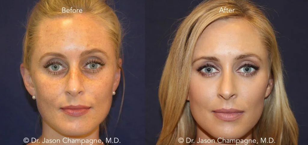 Revitalizing Your Appearance with Plastic Surgery in Maryland Revitalizing Your Appearance with Plastic Surgery in Maryland