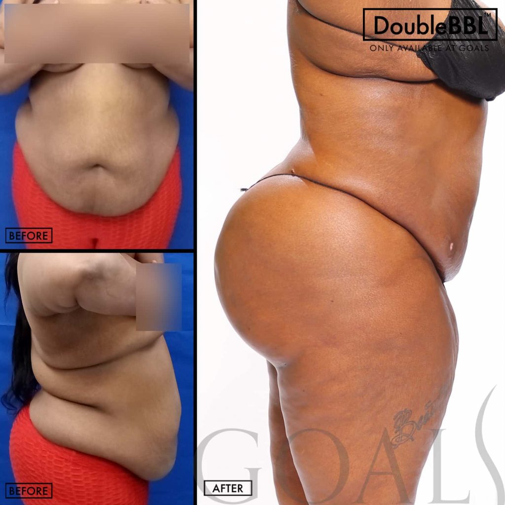 Revitalizing Your Look: Atlanta Goals Plastic Surgery