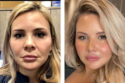 Setting Aspirations for Your Plastic Surgery Transformation Setting Aspirations for Your Plastic Surgery Transformation