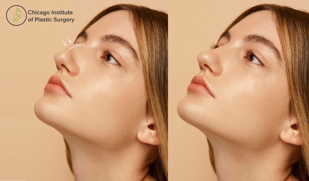 Setting Aspirations for Your Plastic Surgery Transformation Setting Aspirations for Your Plastic Surgery Transformation