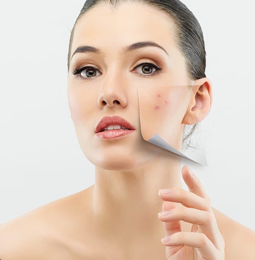 The Role of Lamprobe in Treating Broken Capillaries The Role of Lamprobe in Treating Broken Capillaries