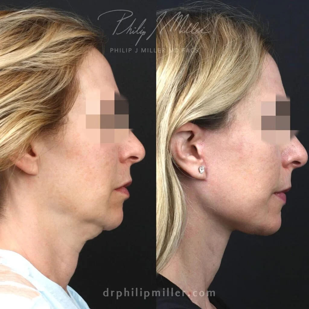 Transform Your Look with Plastic Surgery in NYC Transform Your Look with Plastic Surgery in NYC