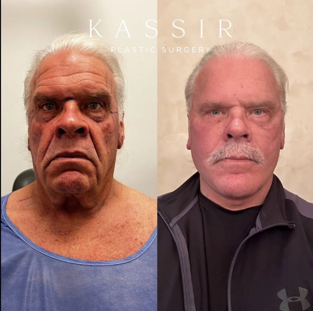 Transform Your Look with Plastic Surgery in NYC Transform Your Look with Plastic Surgery in NYC