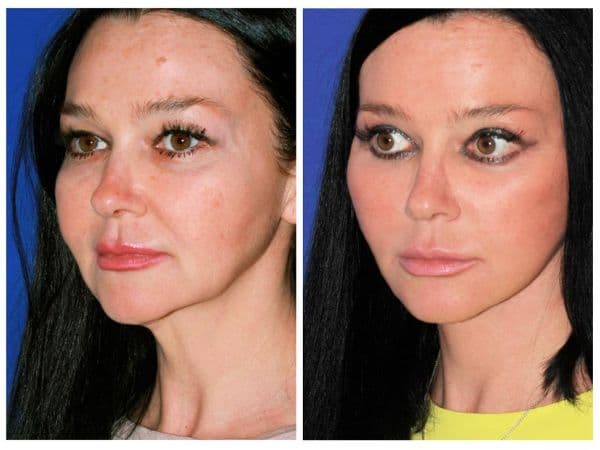 Transforming Your Appearance Through Plastic Surgery in the Bronx Transforming Your Appearance Through Plastic Surgery in the Bronx