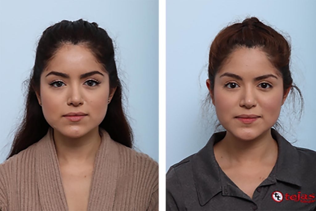 Transforming Your Appearance with Plastic Surgery