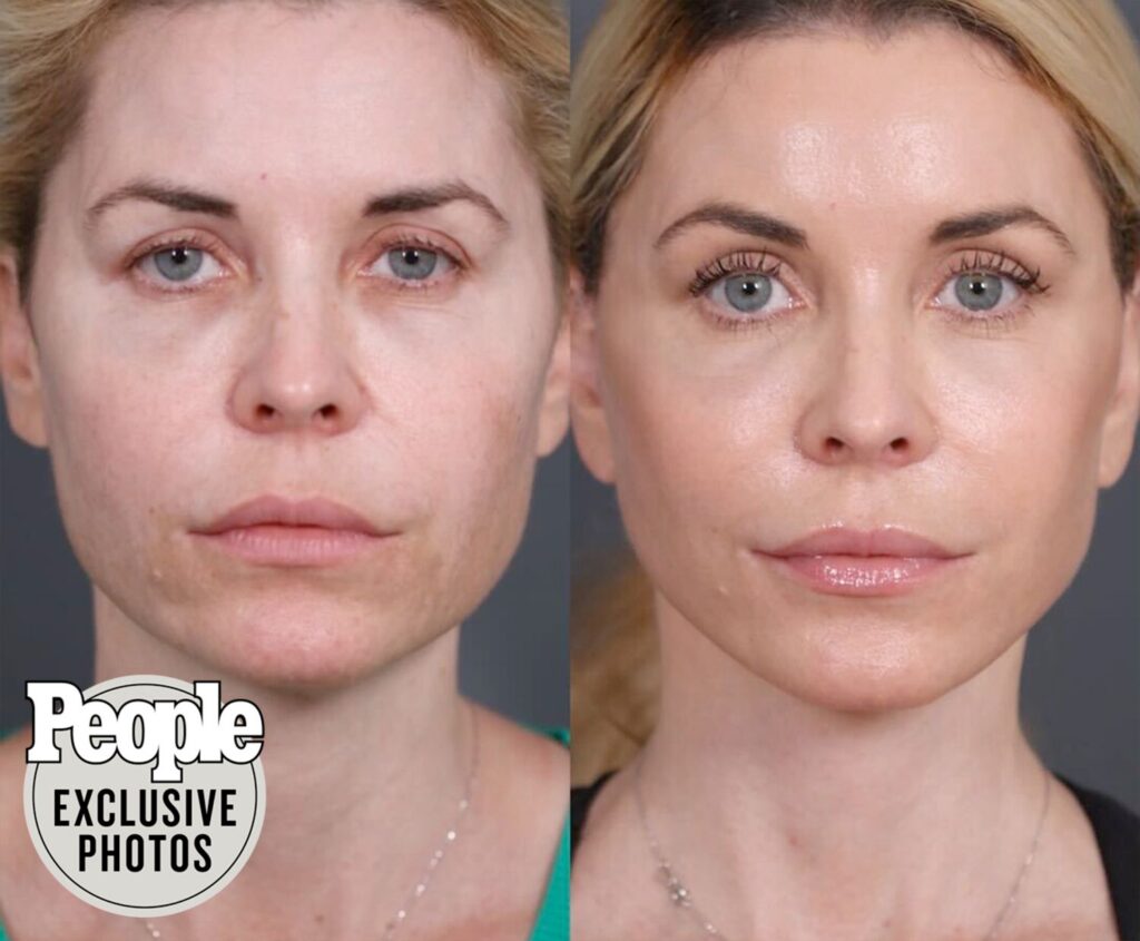 Transforming Your Appearance with Plastic Surgery