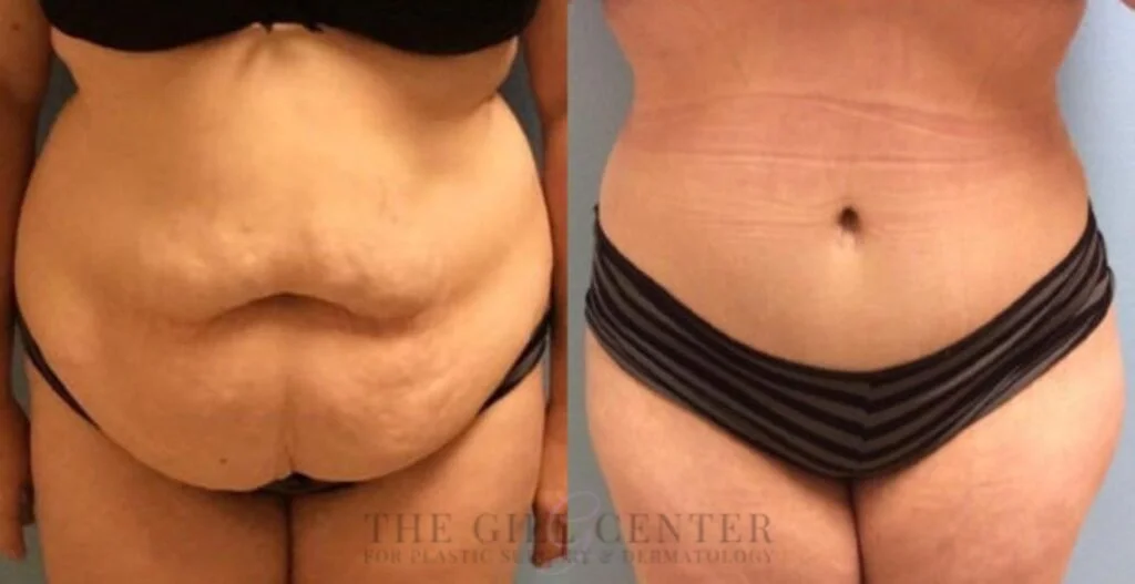 Transforming Your Body through Plastic Surgery
