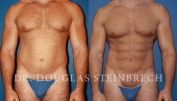 Transforming Your Body through Plastic Surgery