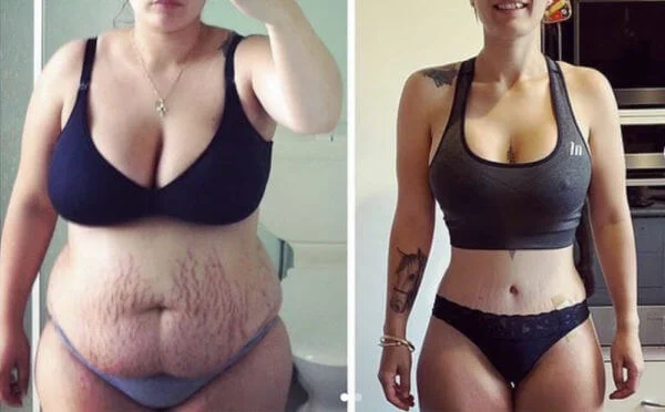 Transforming Your Body through Plastic Surgery