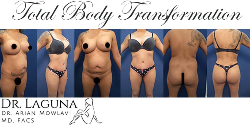 Transforming Your Body through Plastic Surgery