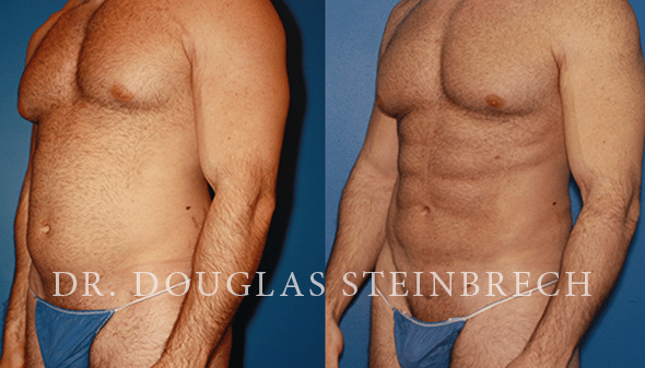 Transforming Your Body through Plastic Surgery