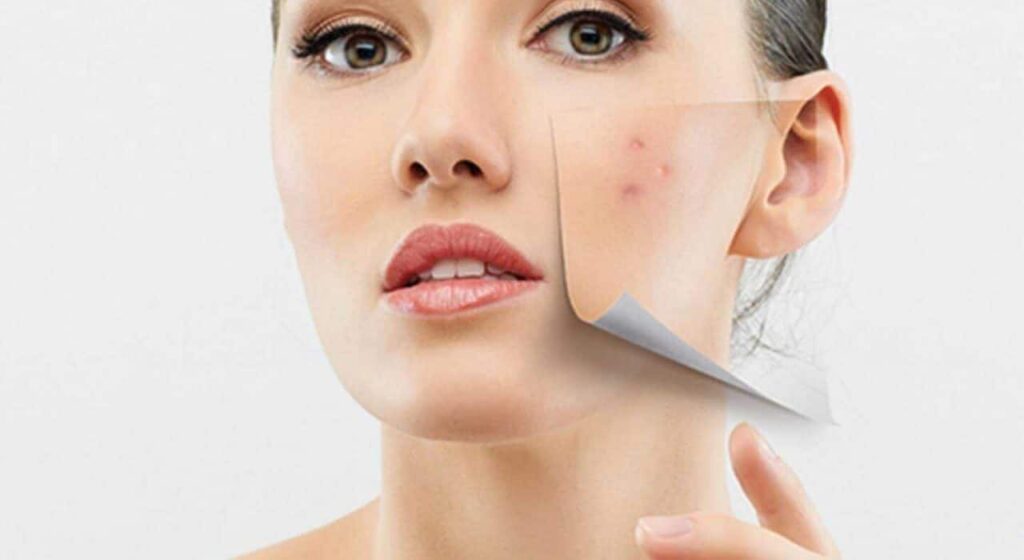 Understanding the Versatility of Lamprobe in Skin Aesthetics Understanding the Versatility of Lamprobe in Skin Aesthetics